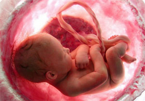 20 weken abortusban